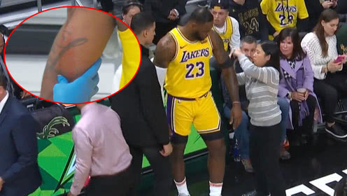 【NBA集錦】賽場激烈程度如戰(zhàn)場 詹皇掛傷流血場邊包扎